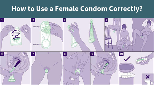 How To Use Female Condom Correctly?