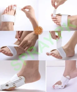 Hallux Valgus Bunion Corrector Splint